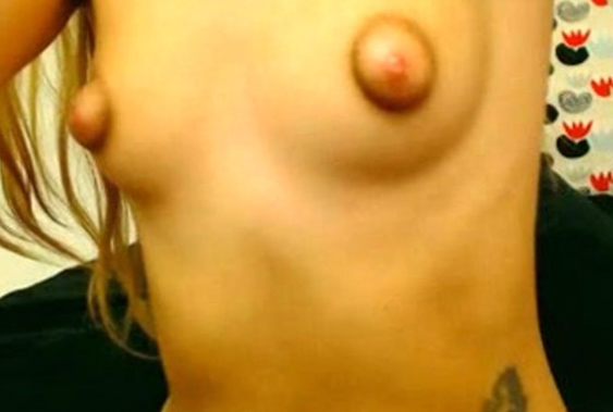 andrea reams add puffy nipples webcam image