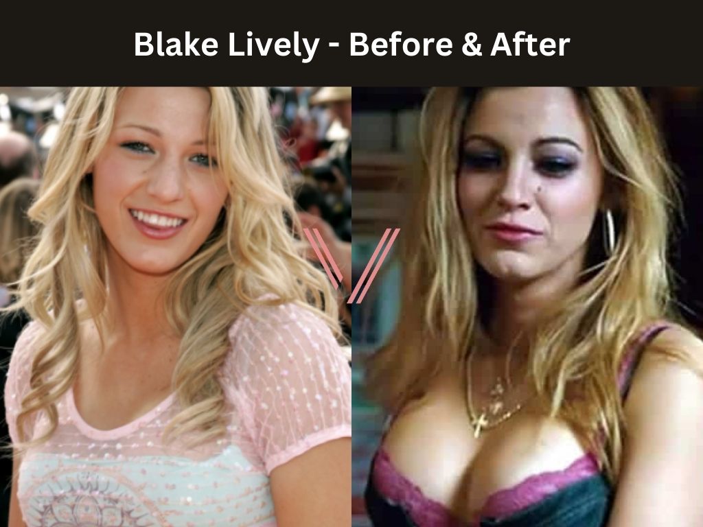 alda barrera add blake lively big tits photo