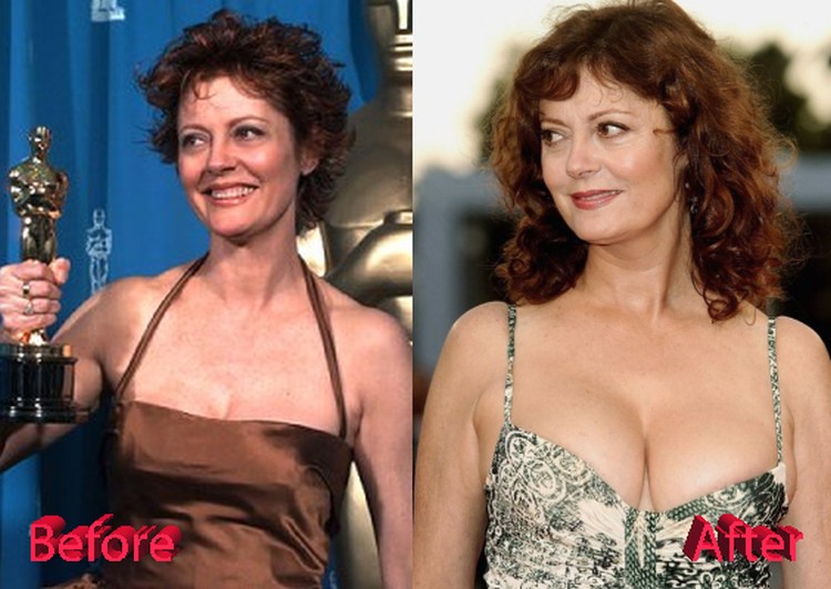 arlene colbert add susan sarandon breasts photo